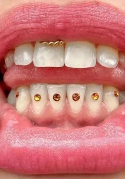 Gemzeez Gold Teeth Gemz Starter Kit
